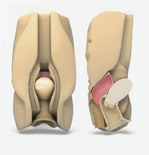 Kadın karın iç organları vajinal küldosentez Laparoskopik simülatör